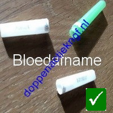 Doppenactiekngf.nl